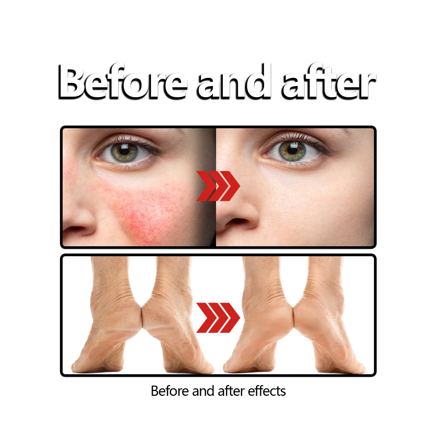 Before and after comparison of facial redness and dry feet, FashionRay skincare results