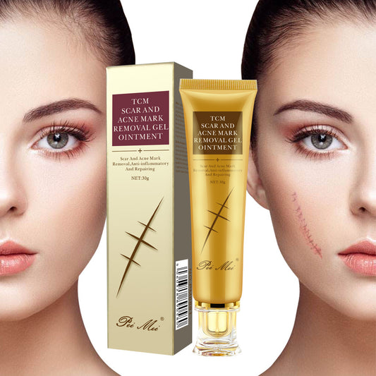 TCM scar and acne mark removal gel ointment with before and after face comparison, FashionRay skincare
