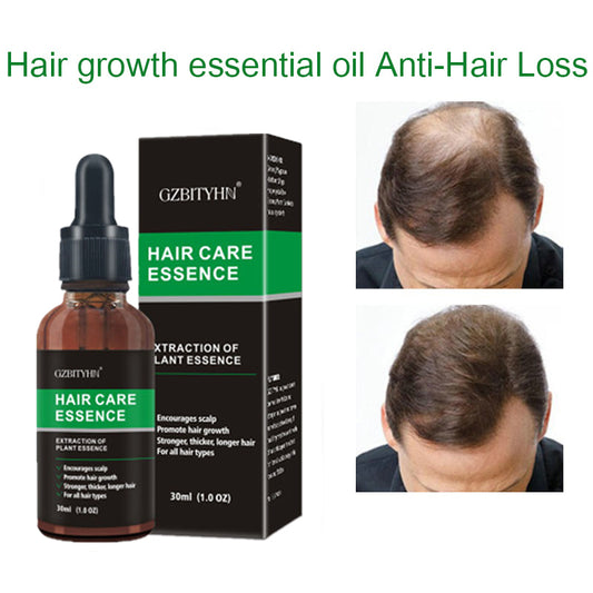 Hair care essence anti-hair loss oil with before and after results, FashionRay wellness product