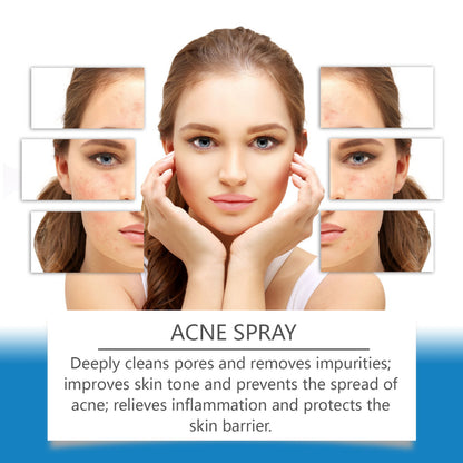 Acne spray skincare ad with woman's clear and acne-affected face comparison, FashionRay style