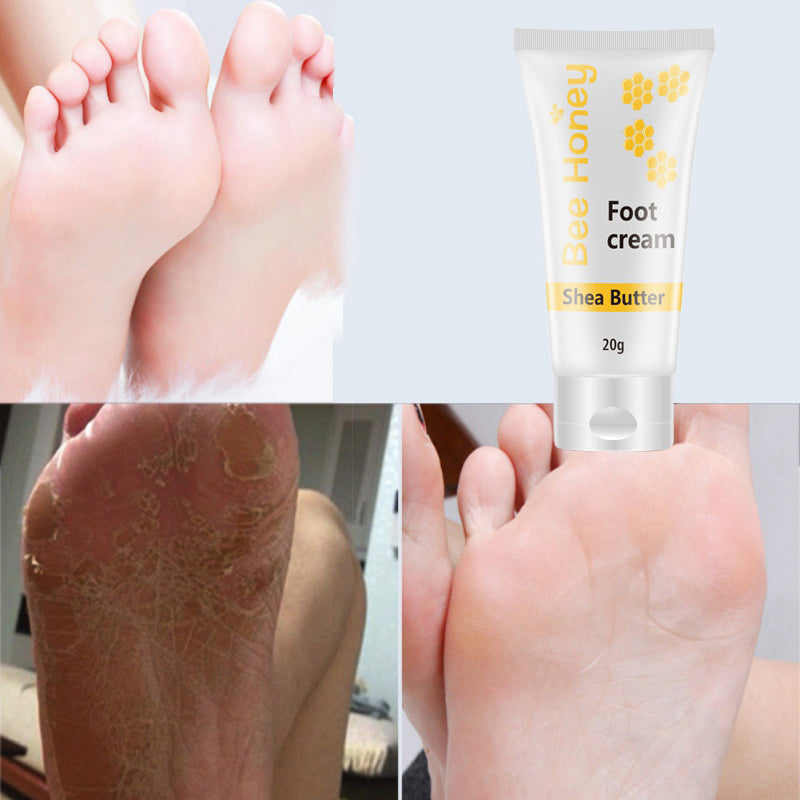 Bee Honey shea butter foot cream with before and after results for dry, cracked feet