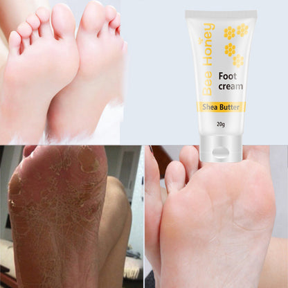Bee Honey shea butter foot cream with before and after results for dry, cracked feet