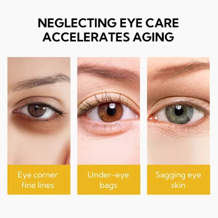 Close-up of eyes showing fine lines, under-eye bags, and sagging skin, with FashionRay branding.