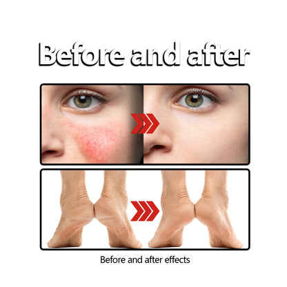 Before and after comparison of facial redness and dry feet, FashionRay skincare results