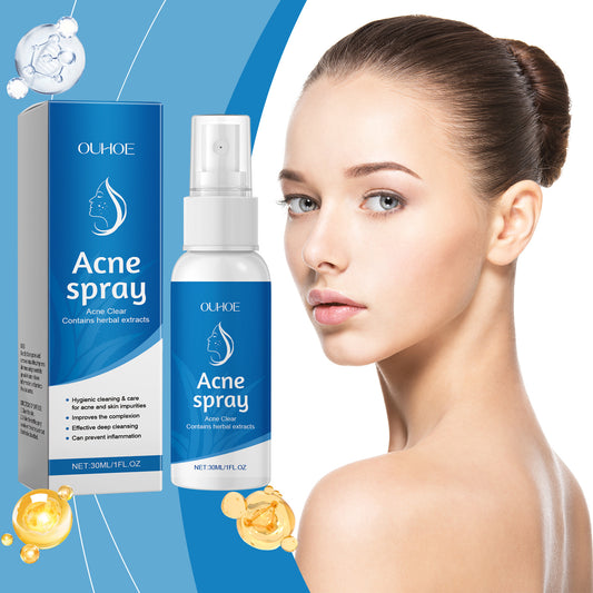 OUHOE acne spray product with blue packaging and a woman with clear skin, FashionRay