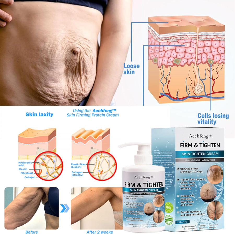 Loose skin and skin laxity graphics with Aechfeng firm and tighten cream for body tightening, FashionRay skincare product
